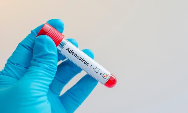 Adenovirus tiếp tục cán mốc hơn 1.400 ca mắc, 7 trẻ tử vong: Cha mẹ cần phân biệt rõ với các bệnh hô hấp thông thường - Ảnh 2.